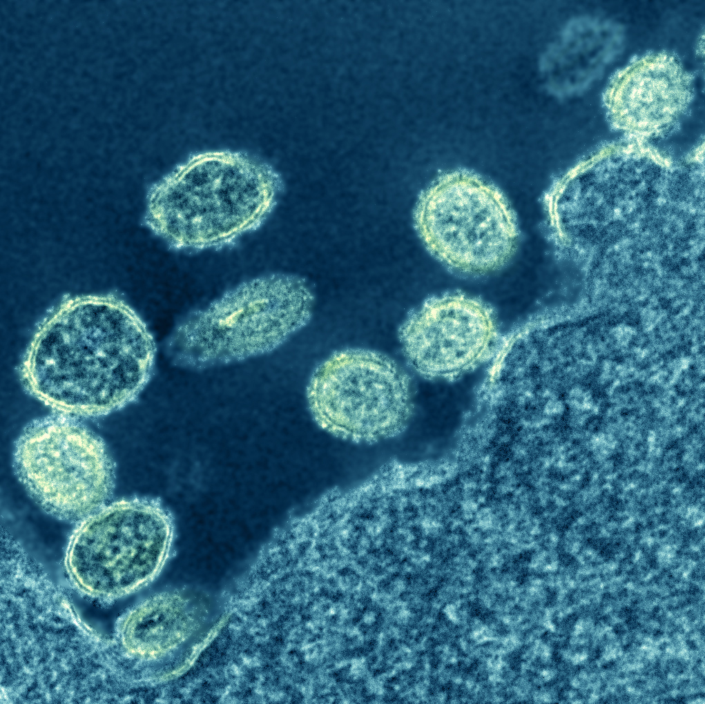 1918 Spanish Flu Virus Particles